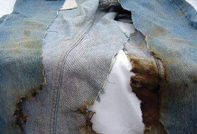Firefighters had to cut Cliff's burned jeans due to the severity of the damage to his knees.